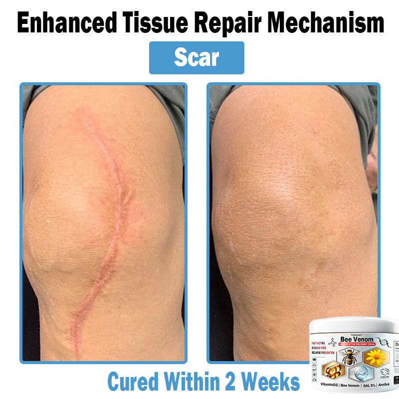 TO𝑫A𝐇OF®𝑩𝒆𝐞 𝑽𝐞𝒏𝒐𝒎 𝑴𝒖𝒍𝒕𝒊-𝑺𝒚𝒎𝒑𝒕𝒐𝒎 𝑺𝒌𝒊𝒏 𝑻𝒓𝐞𝒂𝒕𝒎𝒆𝒏𝒕 𝑪𝒓𝐞𝒂𝒎🌿