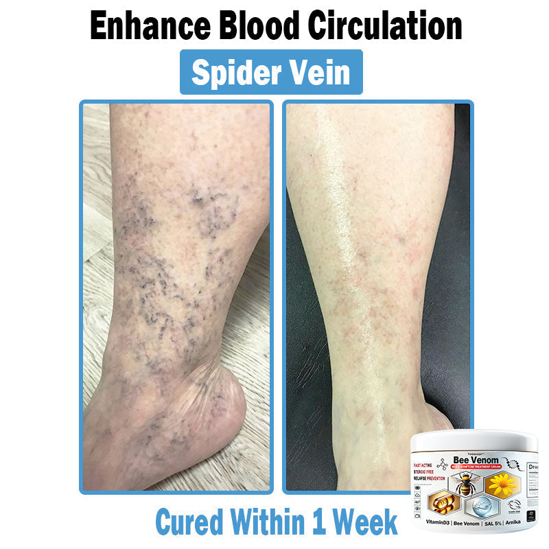 TO𝑫A𝐇OF®𝑩𝒆𝐞 𝑽𝐞𝒏𝒐𝒎 𝑴𝒖𝒍𝒕𝒊-𝑺𝒚𝒎𝒑𝒕𝒐𝒎 𝑺𝒌𝒊𝒏 𝑻𝒓𝐞𝒂𝒕𝒎𝒆𝒏𝒕 𝑪𝒓𝐞𝒂𝒎🌿