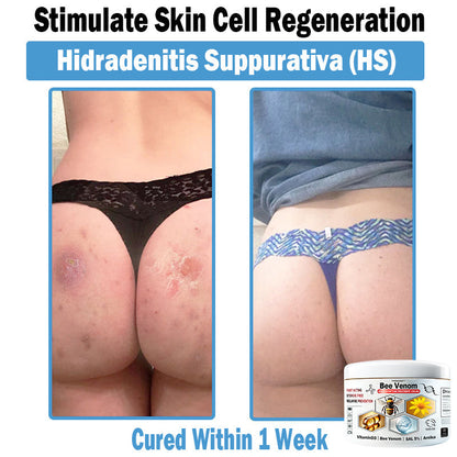 TO𝑫A𝐇OF®𝑩𝒆𝐞 𝑽𝐞𝒏𝒐𝒎 𝑴𝒖𝒍𝒕𝒊-𝑺𝒚𝒎𝒑𝒕𝒐𝒎 𝑺𝒌𝒊𝒏 𝑻𝒓𝐞𝒂𝒕𝒎𝒆𝒏𝒕 𝑪𝒓𝐞𝒂𝒎🌿