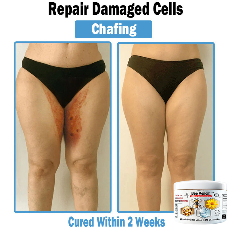 TO𝑫A𝐇OF®𝑩𝒆𝐞 𝑽𝐞𝒏𝒐𝒎 𝑴𝒖𝒍𝒕𝒊-𝑺𝒚𝒎𝒑𝒕𝒐𝒎 𝑺𝒌𝒊𝒏 𝑻𝒓𝐞𝒂𝒕𝒎𝒆𝒏𝒕 𝑪𝒓𝐞𝒂𝒎🌿