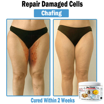 TO𝑫A𝐇OF®𝑩𝒆𝐞 𝑽𝐞𝒏𝒐𝒎 𝑴𝒖𝒍𝒕𝒊-𝑺𝒚𝒎𝒑𝒕𝒐𝒎 𝑺𝒌𝒊𝒏 𝑻𝒓𝐞𝒂𝒕𝒎𝒆𝒏𝒕 𝑪𝒓𝐞𝒂𝒎🌿