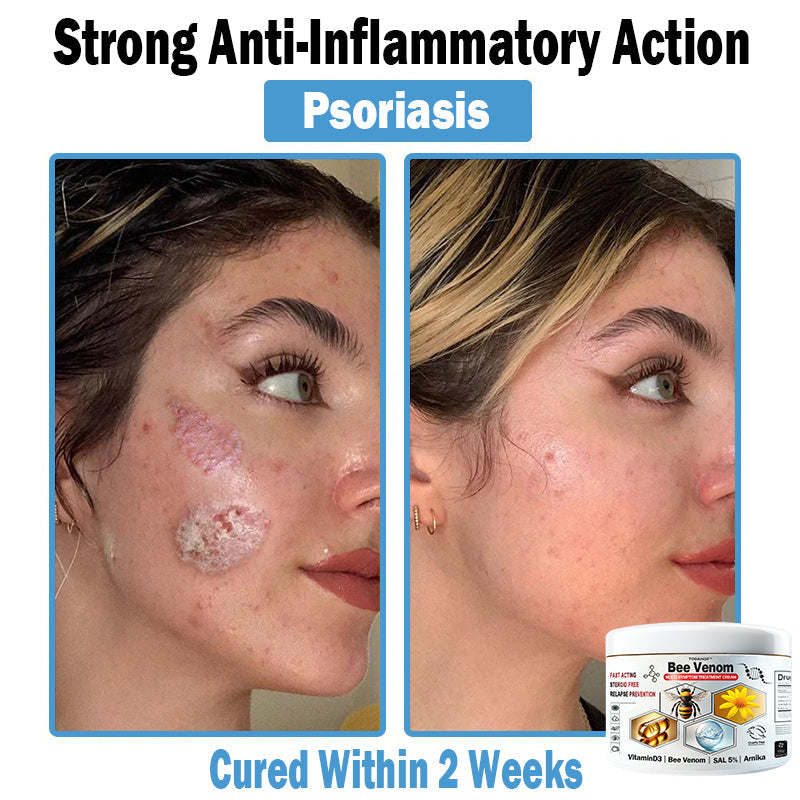 TO𝑫A𝐇OF®𝑩𝒆𝐞 𝑽𝐞𝒏𝒐𝒎 𝑴𝒖𝒍𝒕𝒊-𝑺𝒚𝒎𝒑𝒕𝒐𝒎 𝑺𝒌𝒊𝒏 𝑻𝒓𝐞𝒂𝒕𝒎𝒆𝒏𝒕 𝑪𝒓𝐞𝒂𝒎🌿