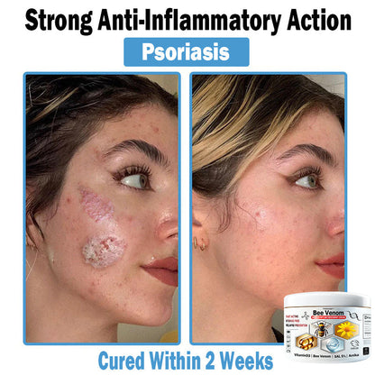 TO𝑫A𝐇OF®𝑩𝒆𝐞 𝑽𝐞𝒏𝒐𝒎 𝑴𝒖𝒍𝒕𝒊-𝑺𝒚𝒎𝒑𝒕𝒐𝒎 𝑺𝒌𝒊𝒏 𝑻𝒓𝐞𝒂𝒕𝒎𝒆𝒏𝒕 𝑪𝒓𝐞𝒂𝒎🌿